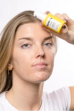 Заспокійлива сироватка проти почервоніння — Acnemy Zitcalm Calming Serum