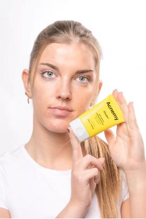 Заспокійливий зволожувальний крем проти почервоніння — Acnemy Zitcalm Moisturizer
