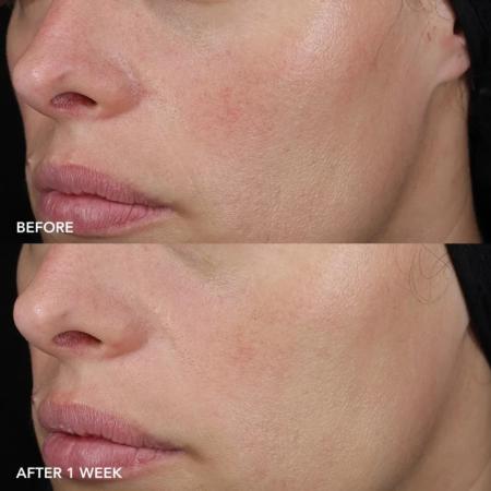 Ніжний відновлювальний бальзам Image Skincare MD Barrier Repair Recovery Balm