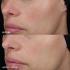 Ніжний відновлювальний бальзам Image Skincare MD Barrier Repair Recovery Balm