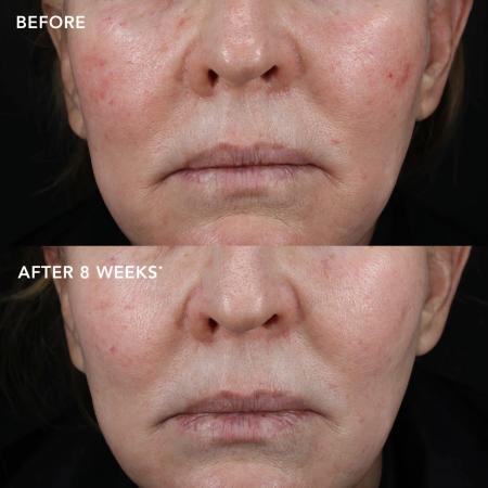 Биотехнологический крем с экзосомами для поддержания долголетия Image Skincare MD Biotech Longevity Creme