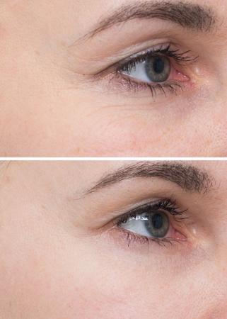 Пілінг - пади INSTYTUTUM Flawless Pads (60peel pads)