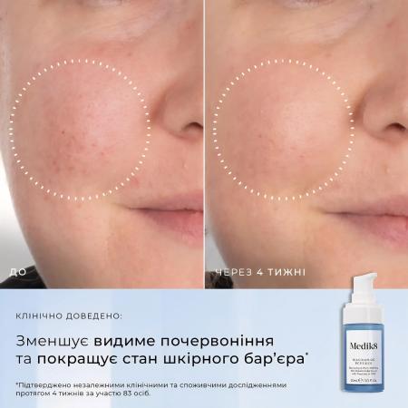 Пептидна сироватка з 10% ніацинаміду Medik8 Niacinamide Peptides