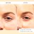 Заспокійливі патчі Patchology Skin Remedy Soothing Eye Gel