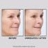 Крем для розгладжування шкіри обличчя Peter Thomas Roth Instant FIRMx Temporary Face Tightener