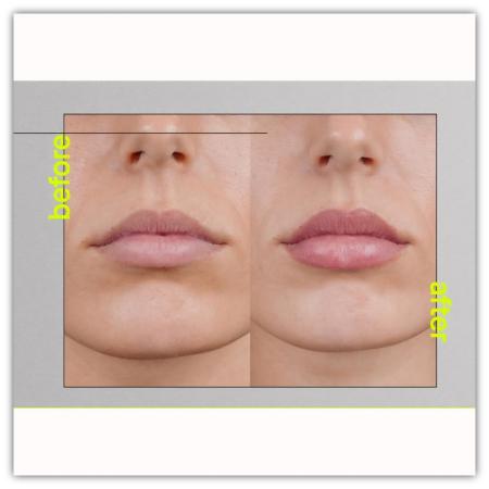 Засіб для зволоження та об'єму губ Transparent lab Volume Hydro-Plump Lip Augmentation